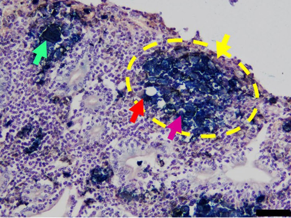 Zitoqueratinaren eta makrofago epiteloideen eginkizuna behien paratuberkulosiarekiko erresilientzian
